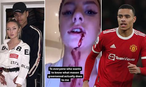 Harriet Robson Mason Greenwood Girlfriend Claims The Manchester United