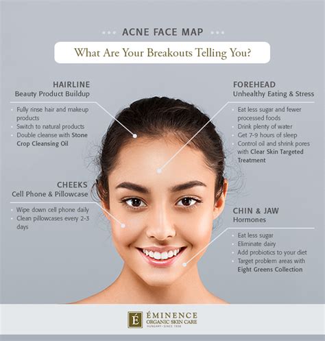 acne face map what are your breakouts telling you eminence organic