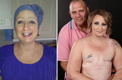 Breast Cancer Survivor Shows Off Mastectomy Scars In