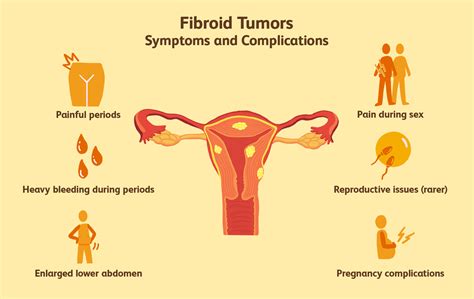 What Is Uterine Fibroids Causes Symptoms And Types Of