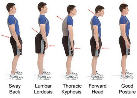 standing posture    supposed  stand elmira family chiropractic