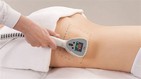 exilis ultra 360 body andresa aesthetics exclusive skin health and