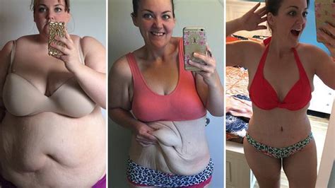Mallory Buettner Woman Wears Bikini For First Time Ever After Losing 85kg