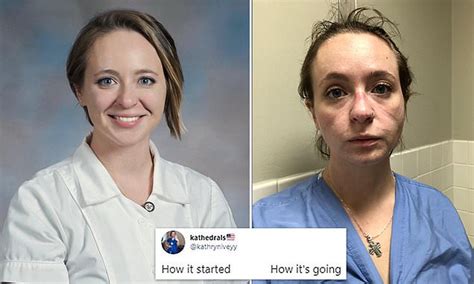 nurse s before and after photos show devastating toll the