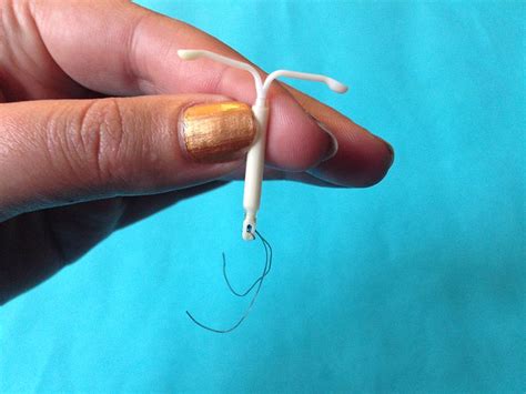 What To Expect After Iud Removal New Health Advisor