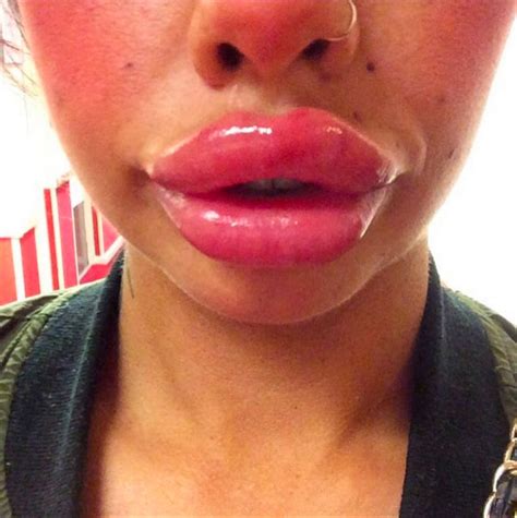 squiggly lips are the latest fad here s what you hope you