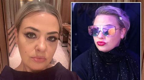 Lisa Armstrong Sports Wonky Lip Liner As She Makes Thinly Veiled Dig