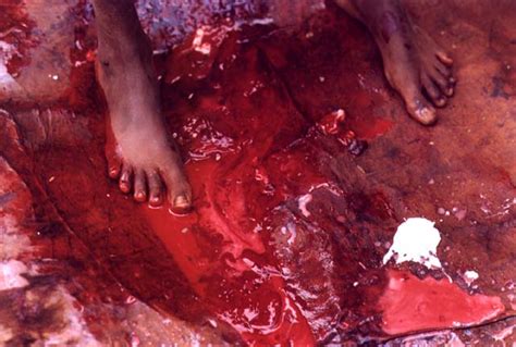 female genital mutilation scars female genital mutilation