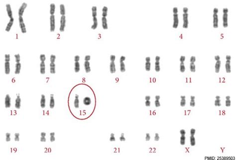 Abnormal Development Genetic Embryology