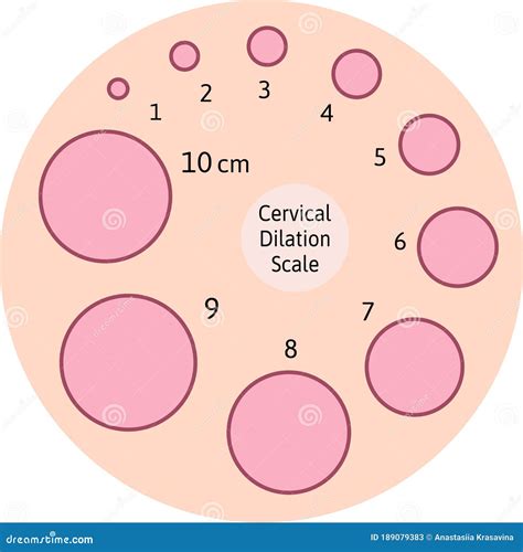 cervial dilation scale  pink circles shows  cervix  opening