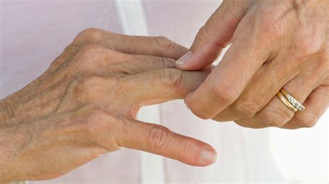 finger joint pain  symptoms  treatment