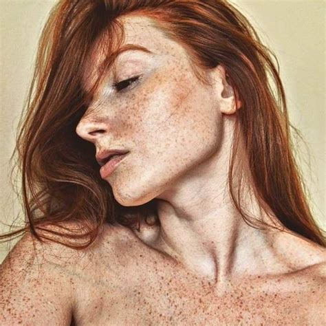 Freckled Beautiful Freckles Redheads Freckles Freckles