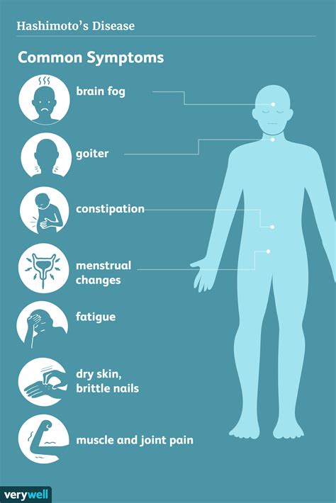 hashimotos disease signs symptoms  complications