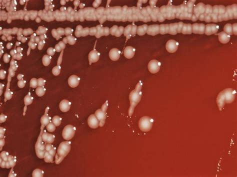 bacteriologia salmonella typhi
