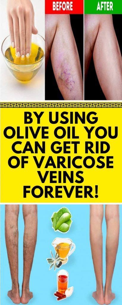 Pin On Health Benefits Of Olive Oil
