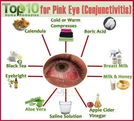 eye care pinkeye remedies pink eyes home remedies