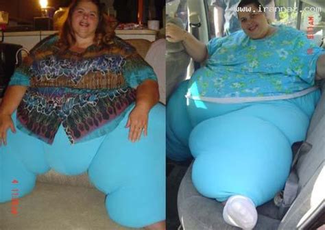 عکس هایی از چاق ترین زن دنیا با 317 کیلوگرم وزن