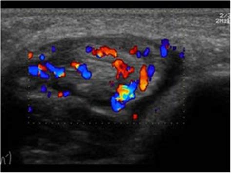 Musculoskeletal Joints And Tendons 6 7 Ankle Case 6 7 9 Lateral