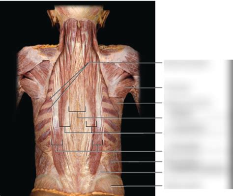 cadaver muscles labeled