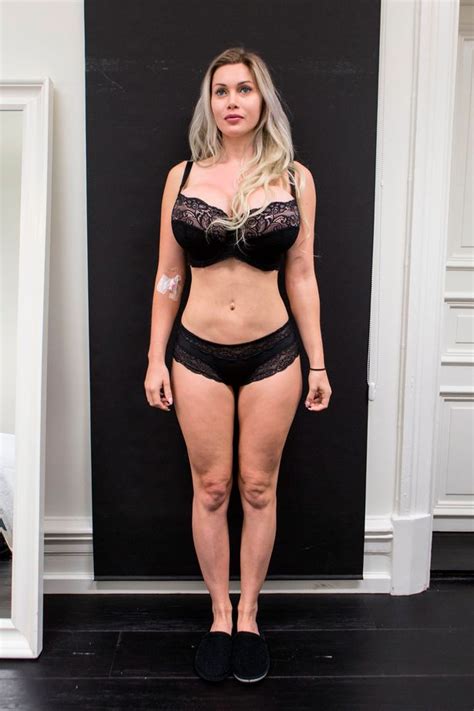 real life barbie doll has fat pumped into her hips bum