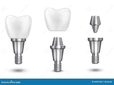 tooth implant vector illustration stock vector illustration  icon background