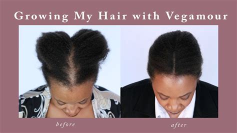 vegamour gro hair serum    vegamour vegalash volumizing mascara review health
