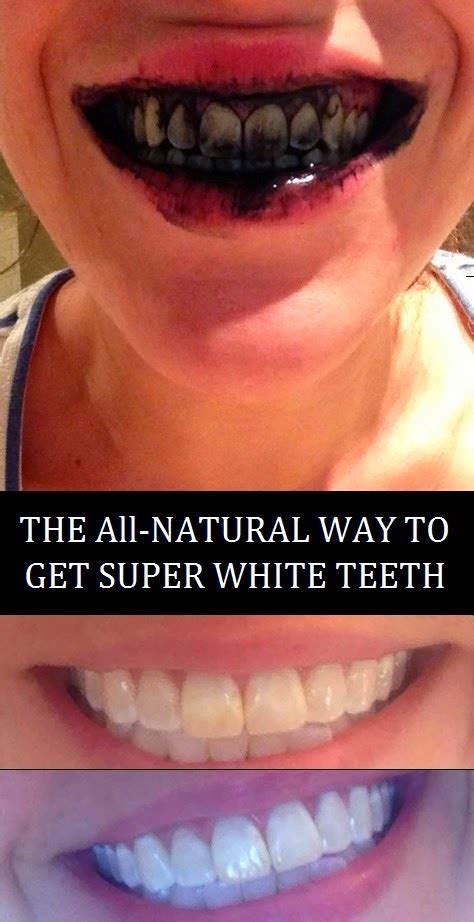 the all natural way to get super white teeth my favorite