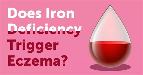 iron deficiency trigger eczema myeczemateam