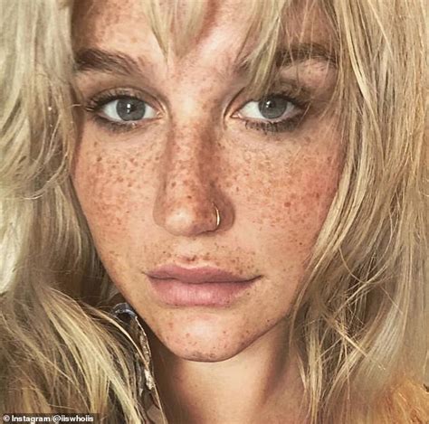kesha vows to love herself and let her freckles live in gorgeous