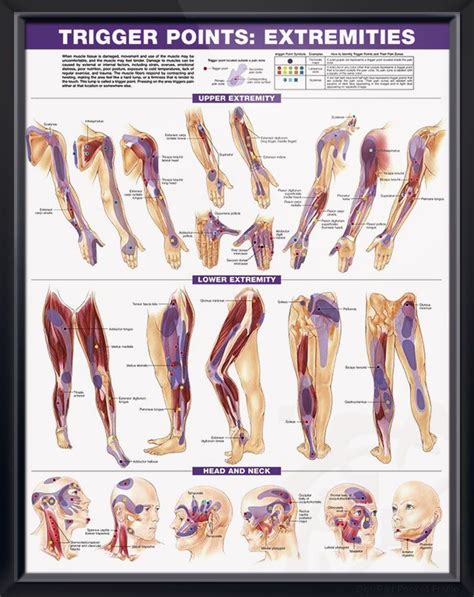 trigger points chart