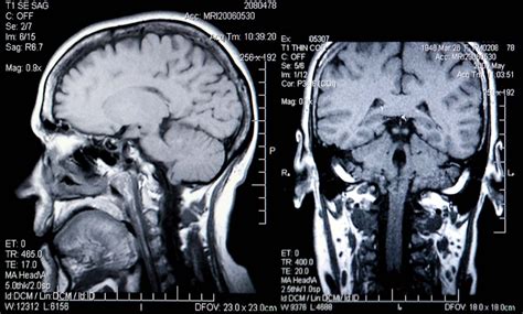 brain scanning mri ct pet imaging britannica