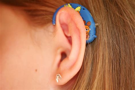 hearing aids nhs