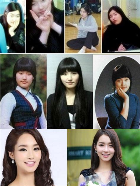 10 shocking photos of korean celebrity plastic surgery