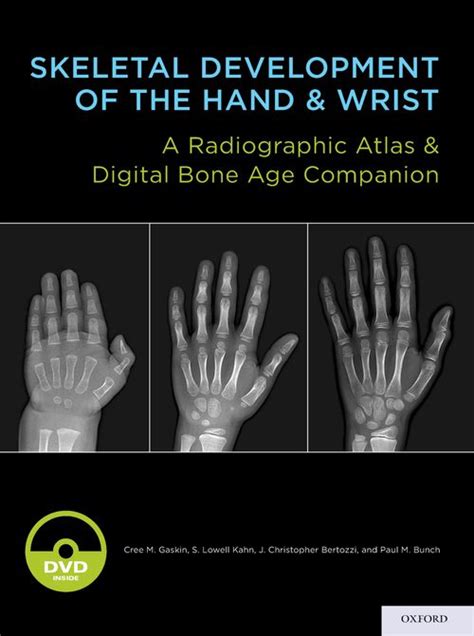 skeletal development of the hand and wrist a radiographic atlas and