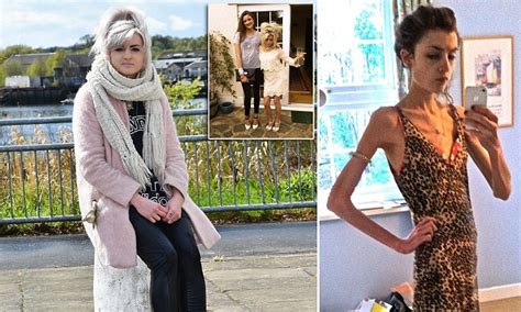 recovering anorexic lydia davies who weighed 4st 11lb wants to help