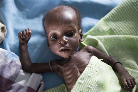 famine emergency starving  south sudan pictures cbs news