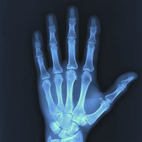 Digital X Ray Imaging Healthcare Specialists