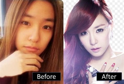 Tiffany Hwang Plastic Surgery Before And After Nose Job