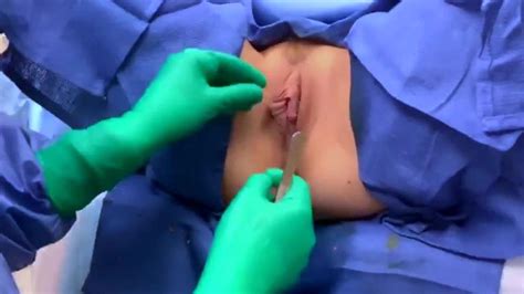 sexy surgeon presents labiaplasty hoodoplasty porn videos