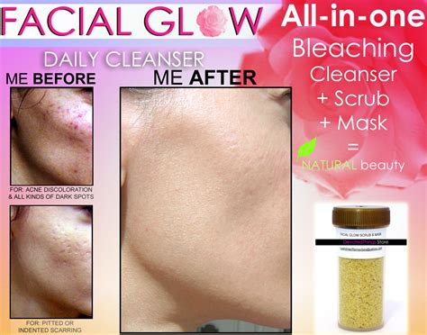 Facial Glow Scrub And Mask Daily Cleanser Acne Scars Skin Bleaching Soap
