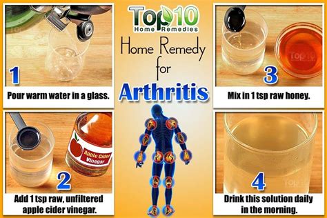 home remedies  arthritis top  home remedies