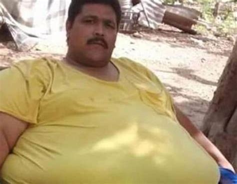 world s most obese man dies after weight loss surgery world