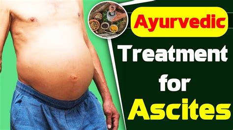 Ayurvedic Treatment For Ascites Herbs For Ascites Ingenious