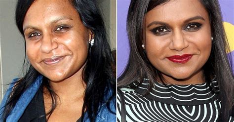 mindy kaling numerous plastic surgeries