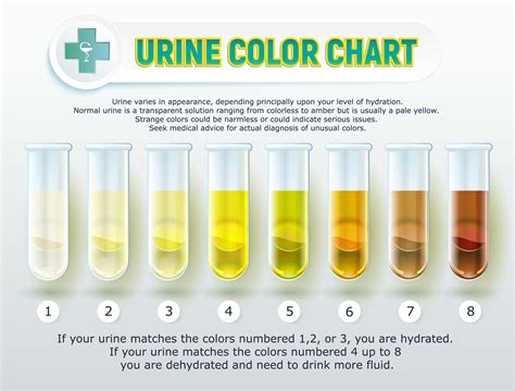 urology infographic   urines color means scaled mcesda urine