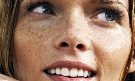 Fade Those Freckles Are Sun Spots And Blotchy Skin Making You Look Old