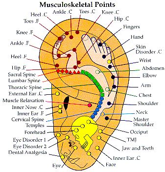 benefits  ear seeds hornburg holistics acupuncture