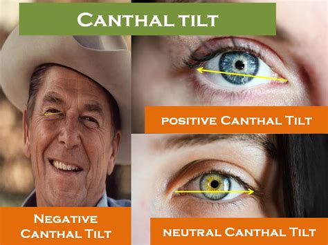 canthal tilt positive  negative tilt ultimate guide