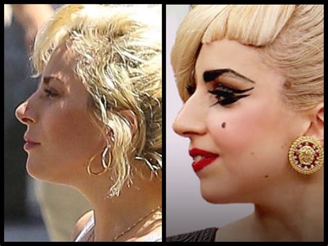 Is Gaga Not Doing Promo Because Of A Nose Job Gaga Thoughts Gaga Daily