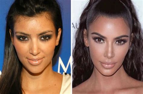 Kim Kardashian Busted Lying About Nose Job The